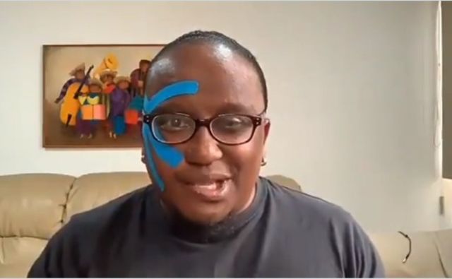 Farándula |»Coquito» sufrió parálisis facial